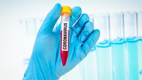 � ������������� ���� ������������ 86 ����� ������� ����������� COVID-19